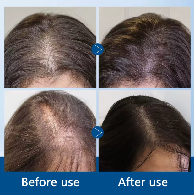 Hair growth serum Roll-on